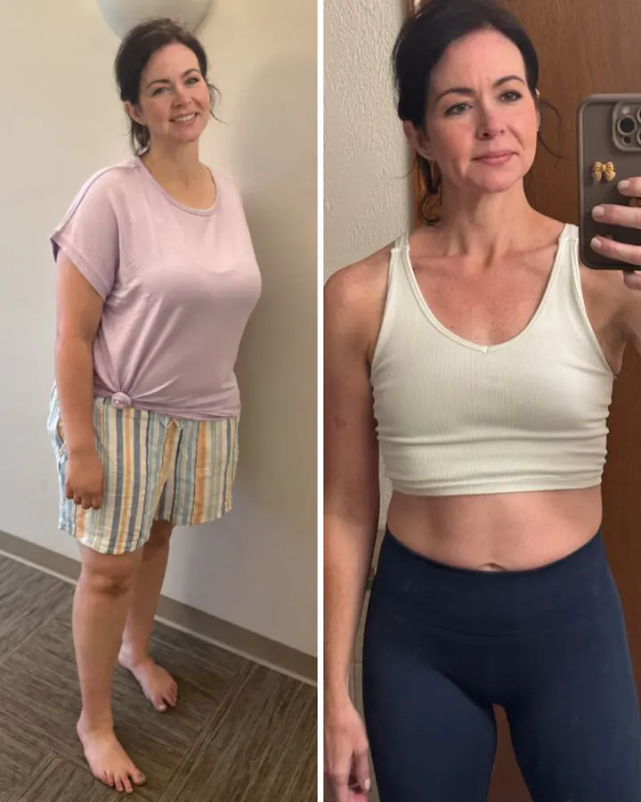 Before and after body transformation