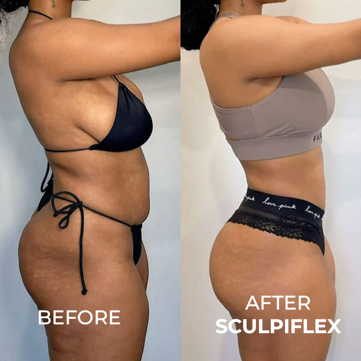 Before and after body transformation