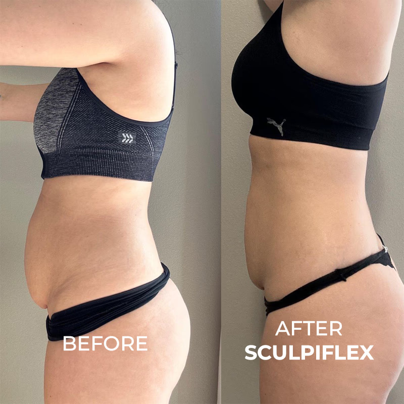 Before and after body transformation